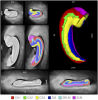 2018 Hippocampal Atlas