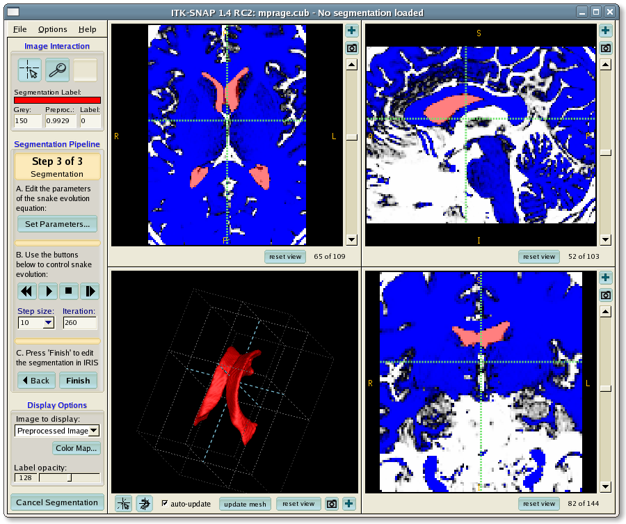 Active contour segmentation