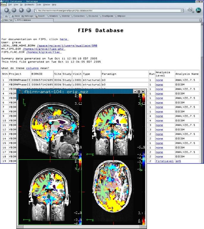 FIPS' Interactive Visualization with Freesurfer