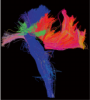 Compressed fibers