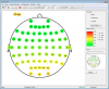 Impedance Measurement
