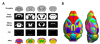 TMBTA template, priors and atlas