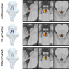 probabilistic LC maps