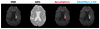 Segmentation results