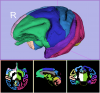 Gray Matter with Parecellation Labels - done with Sizer