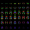 White matter atlas construction with DTI-TK