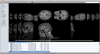 DTI-TK QuickLook Plugin: Finder CoverFlow View