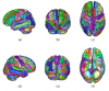 SRI24/TZO parcellation map, projected on cortical surface