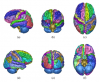 SRI24/LPBA40 parcellation map, projected on cortical surface
