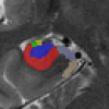 Example segmentation image