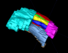 3D rendering of segmentation