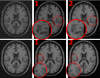 Noisy images (left), original NLM (1), and our software (2)