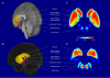 Atlas of the Basal Ganglia