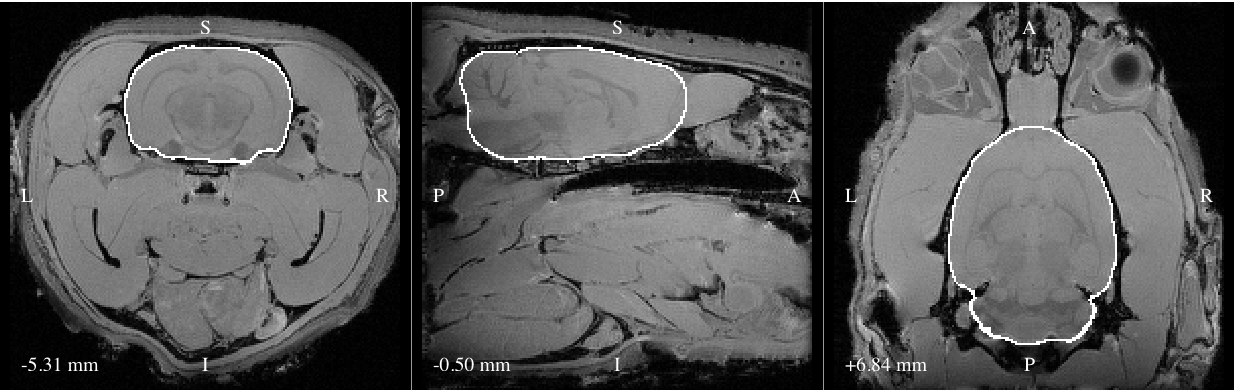 Outline of brain mask generated from a T1-weighted image