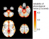 physiological noise map