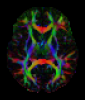 Directional FA from synthetic diffusion-weighted data