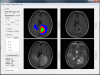 Screenshot of BraTumIA's main interface