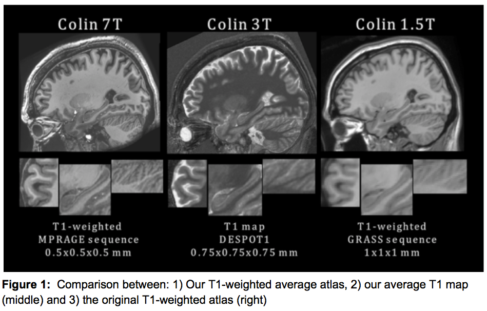 Colin brain atlases