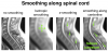 Smoothing along centerline