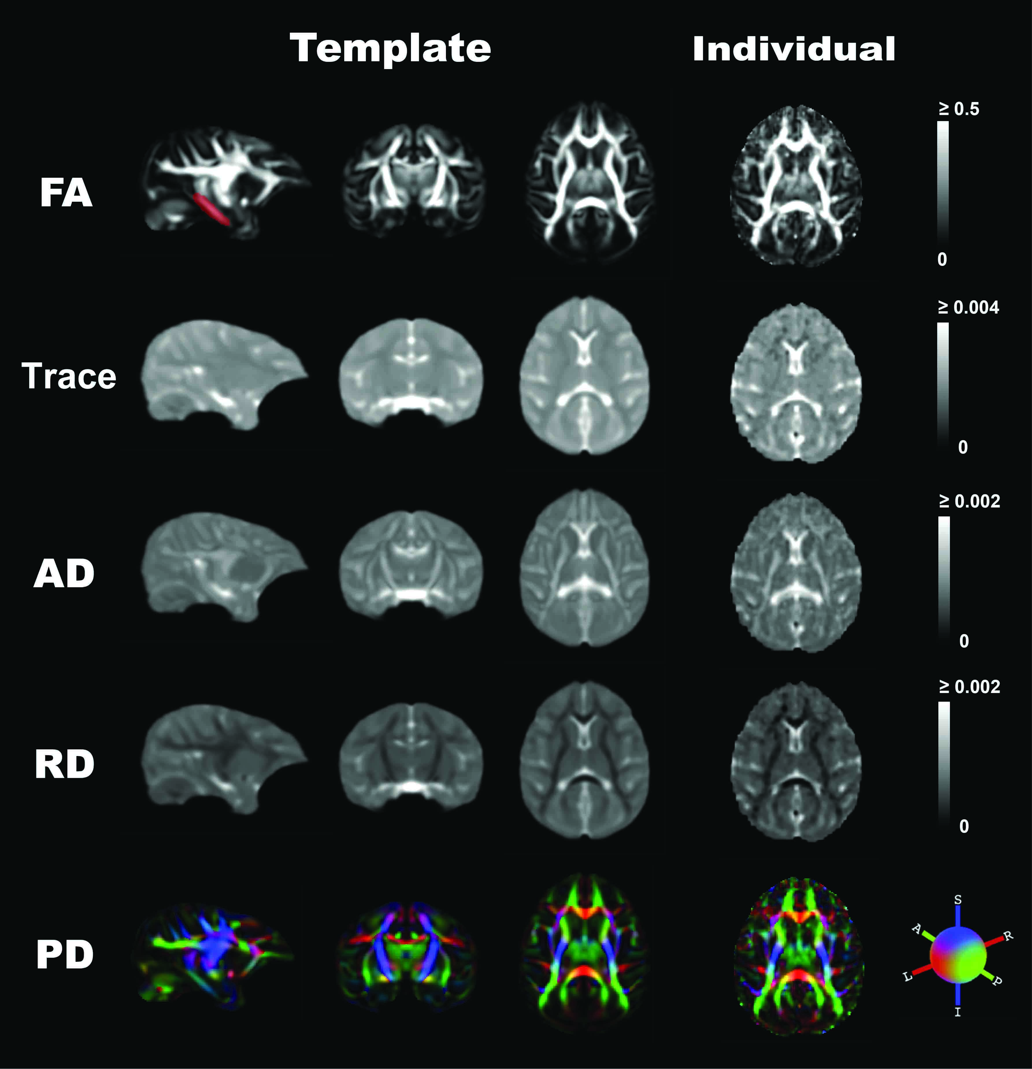DTI template (by DTI-TK)